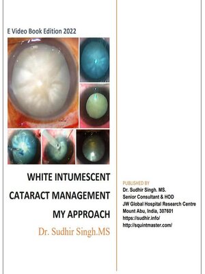 cover image of White Intumescent Cataract Management